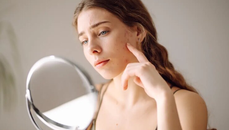 Pürüzsüz ve parlak bir cildin sırrı bu adımlarda saklı: Gözenekleri sıkılaştıran 6 doğal yöntem